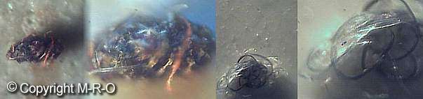 morgellons fuzzballs and fungal slime