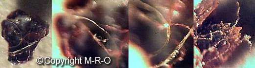 morgellons eggs and cocoons on human blood and skin