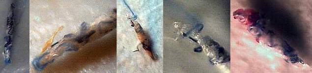 Morgellons fuzzballs and fibers