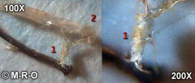 Morgellons insect-like organisms