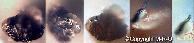 morgellons eggs and cocoons before slipping