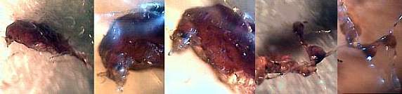Morgellons life form insect-like body with mousehead