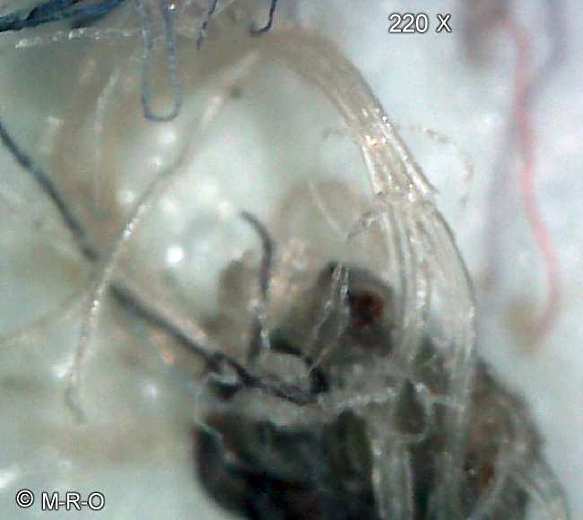morgellons-fiberbus