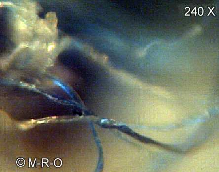 morgellons-fiberbus details
