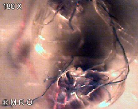 morgellons-fiberbus details