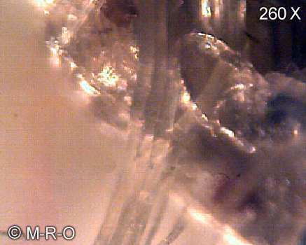 morgellons-fiberbus details
