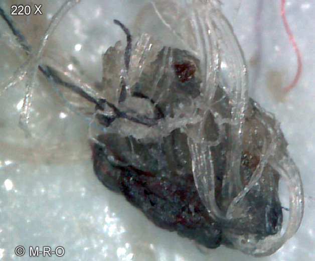 morgellons-fiberbus intelligenz