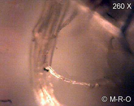 morgellons-fiberbus details