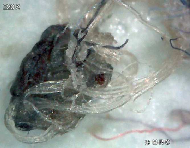 morgellons-fiberbus
