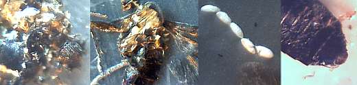 morgellons insect-like forms
