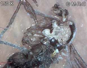morgellons-insects