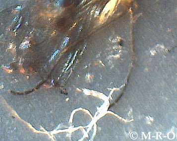 morgellons-insect6.jpg (14872 Byte)