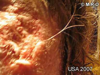 morgellons-lesions