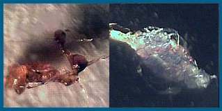 Morgellons Disease Research Organization