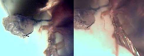 morgellons23.jpg (9638 Byte)