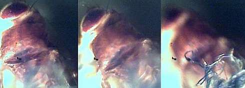 morgellons24.jpg (11883 Byte)