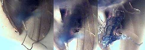 morgellons25.jpg (12551 Byte)