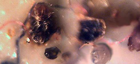 morgellons27.jpg (13617 Byte)