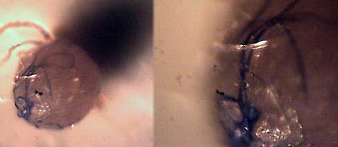 morgellons29.jpg (9386 Byte)