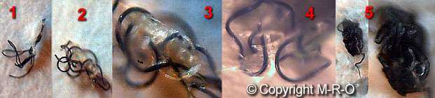 morgellons fiber accumulation gmo