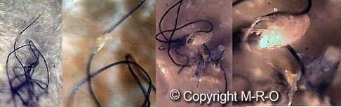 morgellons fibers with insect-like organisms