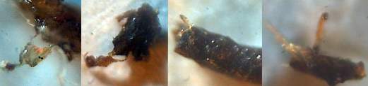 Morgellons Snail varietys