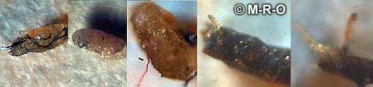 Morgellons cocoons and eggs and larvae