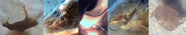 Morgellons fungal slime with fibers