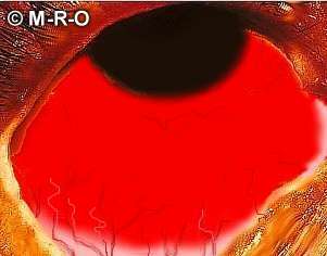 eye.jpg (9019 Byte)