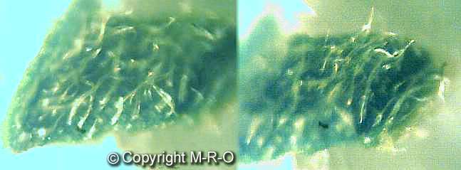 morgellons alga photosyntesis morgellons fibers borrelia
