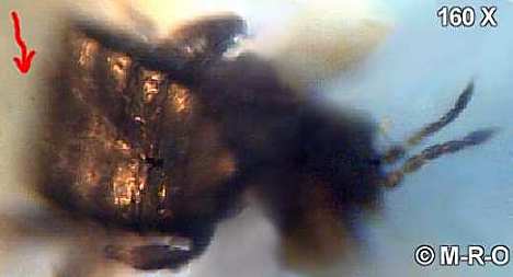 morgellons-bug11.jpg (12314 Byte)