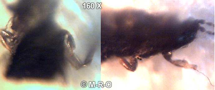 morgellons-bug