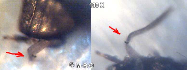 morgellons-bug11.jpg (12314 Byte)