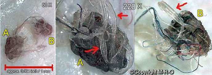 morgellons-fiberbus with multi fiber construction