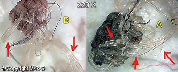 morgellons-fiberbus connected with other organisms
