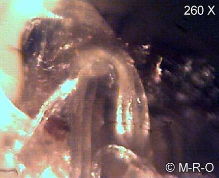 morgellons-fiberbus details