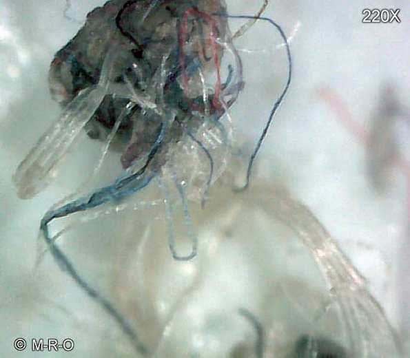 morgellons-fiberbus constructions