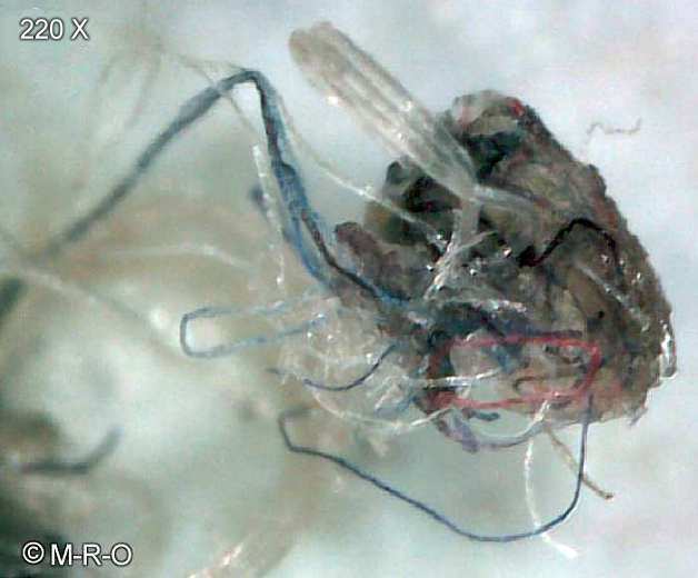 morgellons-fiberbus