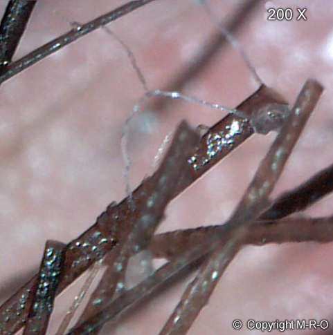 morgellons-net1.jpg (20611 Byte)