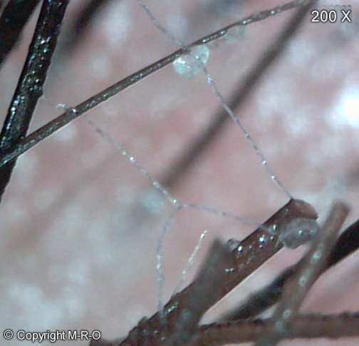 morgellons-net2.jpg (18927 Byte)