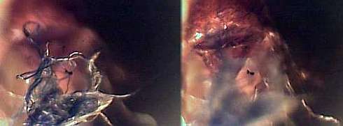 morgellons26.jpg (10870 Byte)