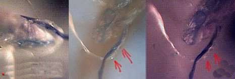 morgellons37.jpg (8462 Byte)