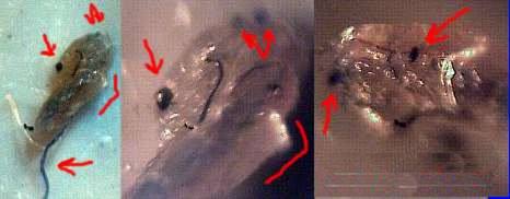 morgellons38.jpg (12630 Byte)