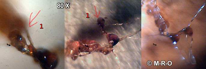 morgellons biofilm fruchtkörper