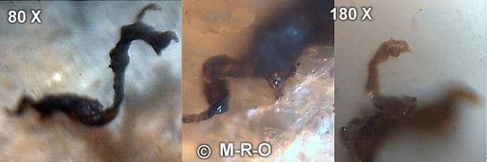 morgellons-gmo-picture