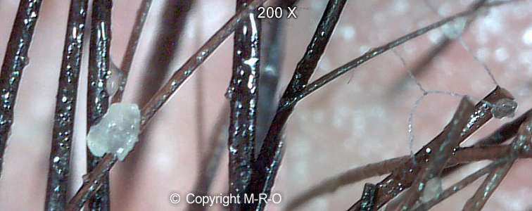 morgellons-hairs