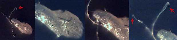 morgellons33.jpg (8922 Byte)