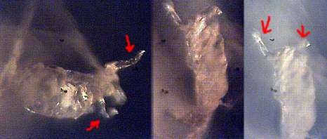 morgellons39.jpg (12433 Byte)