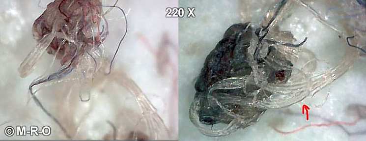 morgellons biofilmfilamente fasern