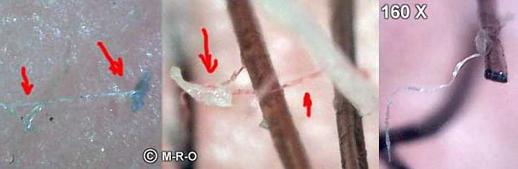 Morgellons biofilmbilder